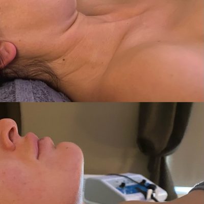 Before and After results for facial tightening massage on one of our clients faces and necks